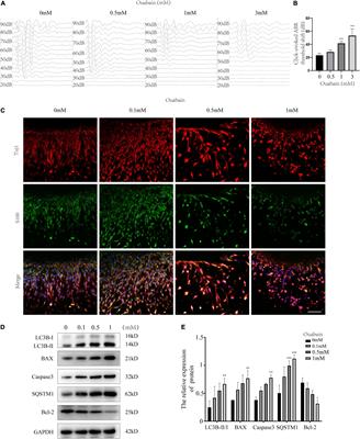 Shikonin Attenuates Cochlear Spiral Ganglion Neuron Degeneration by Activating Nrf2-ARE Signaling Pathway